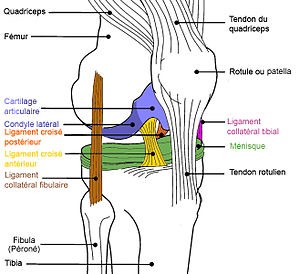 Rupture du Ligament Croisé Antérieur du genou